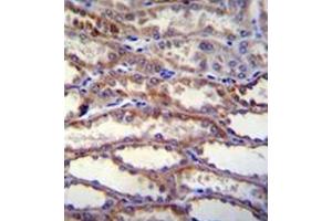 Formalin fixed, paraffin embedded human kidney tissue stained with SHISA3 Antibody (C-term) followed by peroxidase conjugation of the secondary antibody and DAB staining. (SHISA3 antibody  (C-Term))