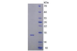Image no. 1 for D-Dopachrome Tautomerase (DDT) (AA 2-118) protein (His tag) (ABIN4990016)