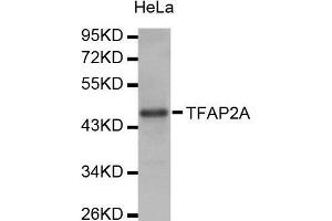 Western Blotting (WB) image for anti-Transcription Factor AP-2 alpha (Activating Enhancer Binding Protein 2 Alpha) (TFAP2A) (AA 1-437) antibody (ABIN1678679) (TFAP2A antibody  (AA 1-437))