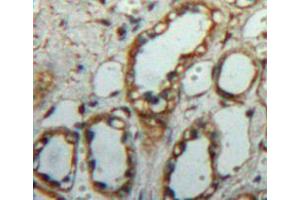 Used in DAB staining on fromalin fixed paraffin-embedded kidney tissue (C1QBP antibody  (AA 72-279))
