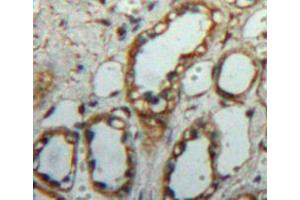 Used in DAB staining on fromalin fixed paraffin-embedded kidney tissue