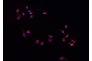 ABIN6268949 staining A-431 cells by IF/ICC. (CXCL1 antibody  (Internal Region))