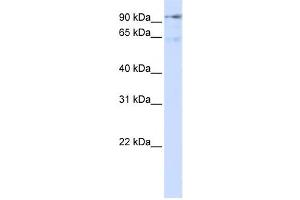 Western Blotting (WB) image for anti-Discs, Large (Drosophila) Homolog-Associated Protein 5 (DLGAP5) antibody (ABIN2458993) (DLGAP5 antibody)