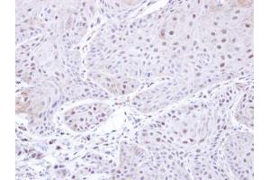 IHC-P Image Immunohistochemical analysis of paraffin-embedded Cal27 xenograft , using PSMC3, antibody at 1:500 dilution. (PSMC3 antibody)