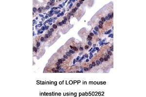 Image no. 2 for anti-Lysyl Oxidase Pro-Peptide (LOPP) (AA 78-115), (Internal Region) antibody (ABIN363571) (LOPP antibody  (Internal Region))