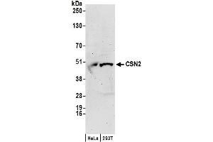 Western Blotting (WB) image for anti-Casein beta (CSN2) (AA 1-50) antibody (ABIN7449364)