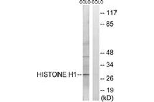 Western blot analysis of extracts from COLO cells, using Histone H1 (Ab-17) Antibody. (Histone H1 antibody  (AA 1-50))