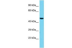 Host: Rabbit Target Name: EXD2 Sample Type: HepG2 Whole Cell lysates Antibody Dilution: 1. (EXD2 antibody  (Middle Region))
