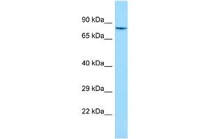 WB Suggested Anti-SHKBP1 Antibody Titration: 1. (SHKBP1 antibody  (N-Term))