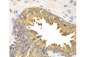 Immunohistochemistry of paraffin-embedded Human prostate using RIG-I / DDX58 Polyclonal Antibody at dilution of 1:100 (40x lens). (DDX58 antibody)