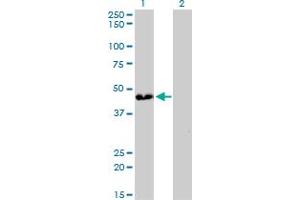 Western Blot analysis of ATP6V0D1 expression in transfected 293T cell line by ATP6V0D1 monoclonal antibody (M01), clone 2G12. (ATP6V0D1 antibody  (AA 238-308))