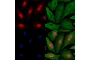 ABIN6263188 and ABIN6279524 staining  cells by IF/ICC.
