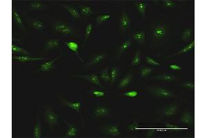 Immunofluorescence of purified MaxPab antibody to ESF1 on HeLa cell. (ESF1 antibody  (AA 1-851))
