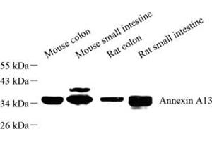 Western blot analysis of Annexin-A13 (ABIN7073062) at dilution of 1: 500 (Annexin A13 antibody)