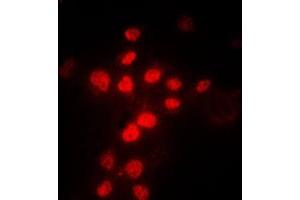 Immunofluorescent analysis of MLH1 staining in HeLa cells.