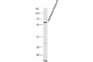 Human Raji lysates probed with Rabbit Anti-MAOB/Monoamine Oxidase B Polyclonal Antibody, Unconjugated  at 1:5000 for 90 min at 37˚C. (Monoamine Oxidase B antibody  (AA 51-150))