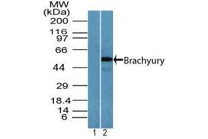 Image no. 2 for anti-T Brachyury Protein (AA 350-400) antibody (ABIN960367) (T Brachyury Protein (AA 350-400) antibody)