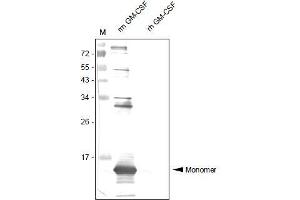 Western Analysis of anti-Mouse GM-CSF Antibody . (GM-CSF antibody  (AA 18-141))