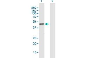 Western Blot analysis of RRM2 expression in transfected 293T cell line ( H00006241-T01 ) by RRM2 MaxPab polyclonal antibody. (RRM2 antibody  (AA 1-389))