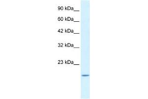 WB Suggested Anti-BAX Antibody Titration:  1. (BAX antibody  (N-Term))