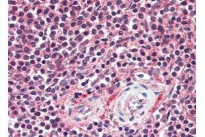 Human Spleen (formalin-fixed, paraffin-embedded) stained with APAF1at 10 µg/ml followed by biotinylated goat anti-rabbit IgG secondary antibody, alkaline phosphatase-streptavidin and chromogen. (APAF1 antibody  (C-Term))