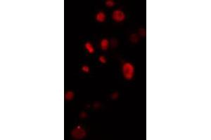 ABIN6274504 staining Hela cells by IF/ICC. (ZNF541 antibody  (Internal Region))