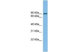 WB Suggested Anti-ERCC3 Antibody Titration: 0. (ERCC3 antibody  (N-Term))