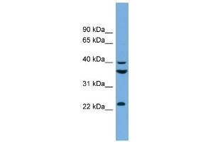 WB Suggested Anti-SAE1 Antibody Titration: 0. (SAE1 antibody  (N-Term))