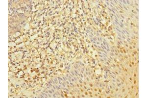 Immunohistochemistry of paraffin-embedded human tonsil tissue using ABIN7167590 at dilution of 1:100 (RGS1 antibody  (AA 1-181))