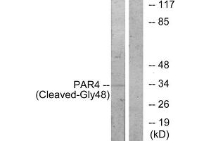 Western blot analysis of extracts from 3T3 cells, treated with etoposide (etoposide, 1hour), using PAR4 (Cleaved-Gly48) antibody. (F2RL3 antibody  (Cleaved-Gly48, N-Term))