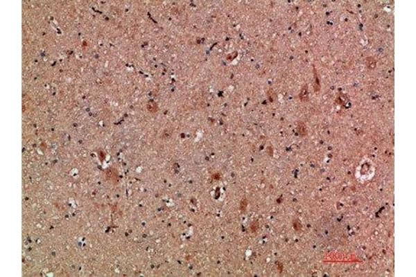 CLCF1 antibody  (AA 171-220)