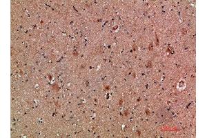 Immunohistochemical analysis of paraffin-embedded human-brain, antibody was diluted at 1:200 (CLCF1 antibody  (AA 171-220))