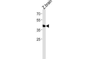 Western Blotting (WB) image for anti-Transcription Factor AP-2 epsilon (Activating Enhancer Binding Protein 2 Epsilon) (TFAP2E) antibody (ABIN3004620) (TFAP2E antibody)