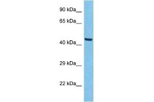 Host:  Rabbit  Target Name:  ACHB3  Sample Type:  A549 Whole Cell lysates  Antibody Dilution:  1. (ACHB3 antibody  (N-Term))