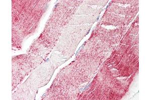 Human, Skeletal muscle: Formalin-Fixed Paraffin-Embedded (FFPE). (XYLT2 antibody  (AA 722-771))