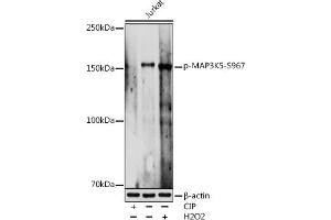 Western blot analysis of extracts of Jurkat cells, using Phospho-MK5-S967 antibody (ABIN7268655) at 1:1000 dilution. (ASK1 antibody  (pSer967))