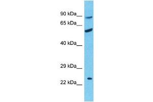 Host:  Rabbit  Target Name:  RHCE  Sample Type:  Uterus Tumor lysates  Antibody Dilution:  1. (RHCE antibody  (Middle Region))