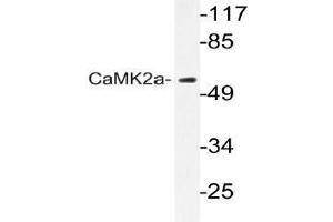 Western blot (WB) analyzes of CaMK2-a antibody in extracts from A431 cells. (CAMK2A antibody)