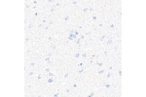 Immunohistochemistry of paraffin-embedded Human brain (negative control sample) using CD7 antibody (ABIN7266214) at dilution of 1:10000 (40x lens). (CD7 antibody)