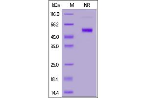 Fed Human CD27 Ligand, His,Flag Tag on  under ing (NR) condition. (CD70 Protein (AA 52-193) (His tag,DYKDDDDK Tag,FITC))