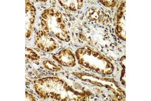 Immunohistochemistry of paraffin-embedded human kidney using SMAD9 antibody (ABIN5975592) at dilution of 1/100 (40x lens). (SMAD9 antibody)