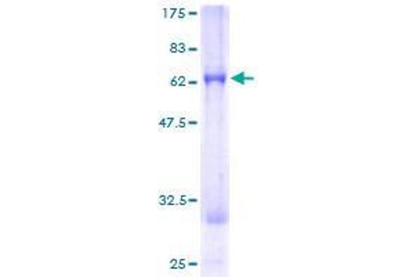 CAMK1D Protein (AA 1-385) (GST tag)