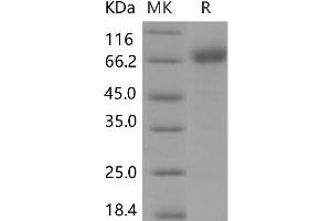 Western Blotting (WB) image for Interleukin 1 Receptor, Type I (IL1R1) (Active) protein (Fc Tag) (ABIN7320140)