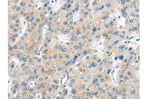 Immunohistochemistry (IHC) image for anti-Vacuolar Protein Sorting-Associated Protein 26A (VPS26A) antibody (ABIN5959956) (VPS26A antibody)