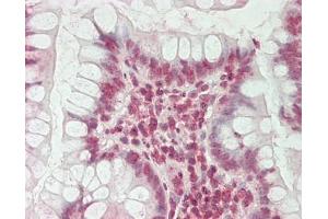Human Small Intestine: Formalin-Fixed, Paraffin-Embedded (FFPE) (HERC2 antibody  (AA 4784-4834))