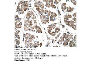Rabbit Anti-ACTN2 Antibody  Paraffin Embedded Tissue: Human Muscle Cellular Data: Skeletal muscle cells Antibody Concentration: 4. (ACTN2 antibody  (C-Term))