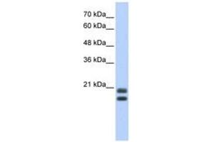 Image no. 1 for anti-serglycin (SRGN) (AA 71-120) antibody (ABIN6742973) (SRGN antibody  (AA 71-120))