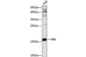 Western blot analysis of extracts of Raji cells, using HBB antibody (ABIN6133523, ABIN6141639, ABIN6141641 and ABIN6217257) at 1:1000 dilution.