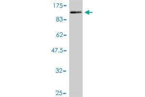 Western Blot detection against Immunogen (91. (PDLIM5 antibody  (AA 1-596))