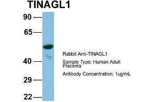 Host: Rabbit Target Name: CHAD Sample Type: Human Adult Placenta Antibody Dilution: 1. (TINAGL1 antibody  (Middle Region))